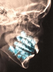 صحة الأسنان - أشعة للأسنان